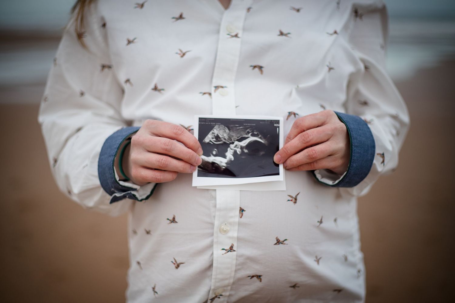 Maternity photography Aberdeen, image 8