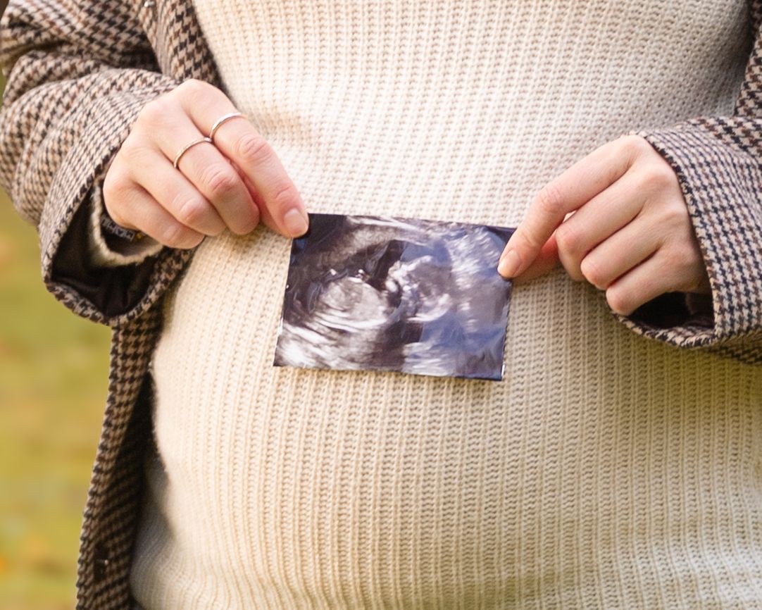 Maternity photography Aberdeen, image 21